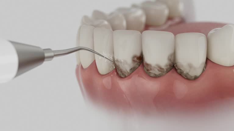 Trusted Teeth Cleaning And Checkup service in Gilbert, IA - Dentist Open Now